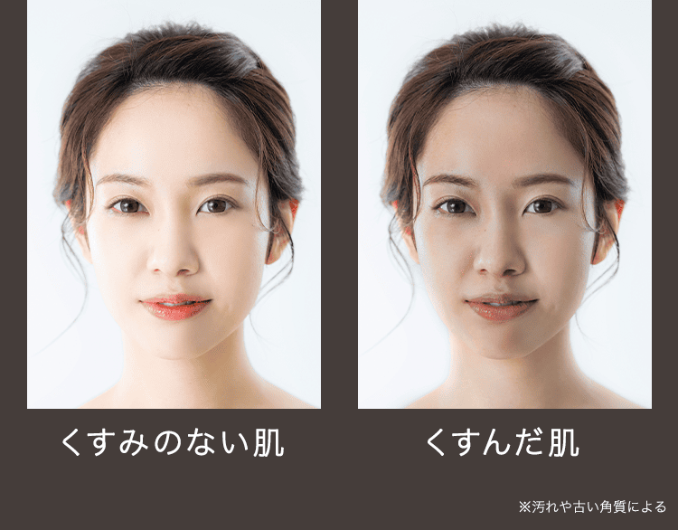 くすみBA
