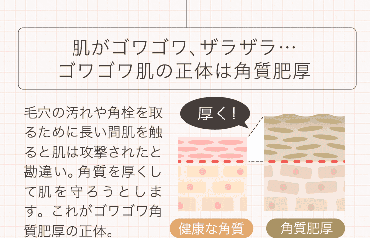 角質肥厚